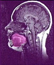vocal tract MRI from movie about how to sing