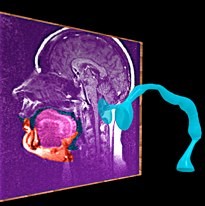 singing resonance vocal tract MRI from movie about how to sing