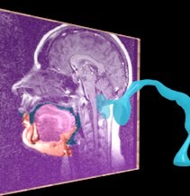articulation 3D animation MRI vocal tract