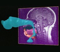 vocal tract MRI still from movie