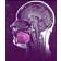 vocal tract MRI from movie about how to sing